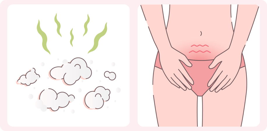 Симптомы бактериального вагиноза